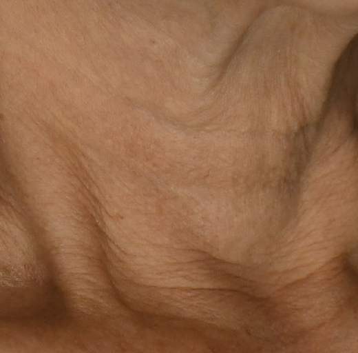 Before/After Image